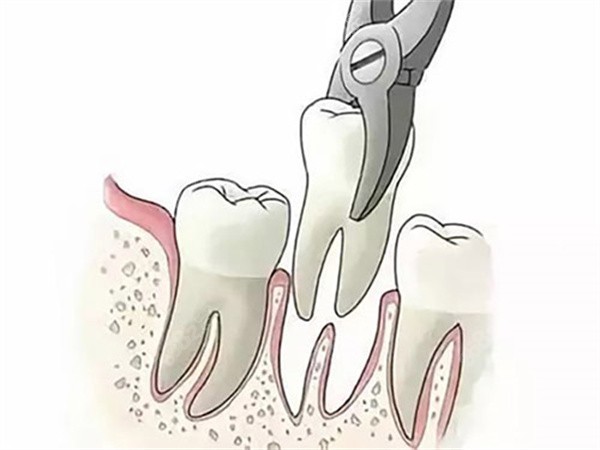 中南大學(xué)湘雅口腔醫(yī)院收費標(biāo)準(zhǔn)