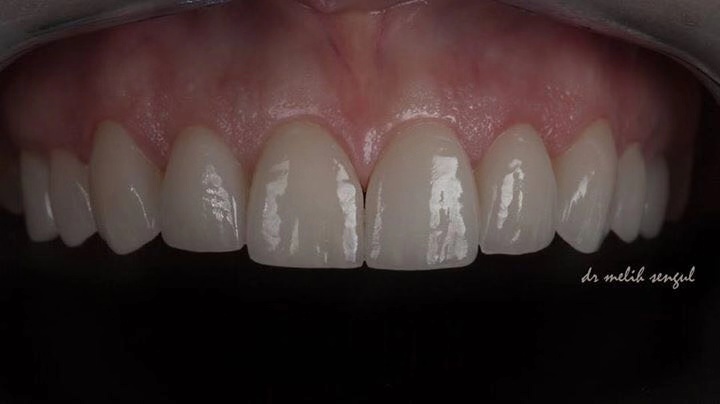 莆田牙先生口腔門診在哪？便捷預約與就診提示