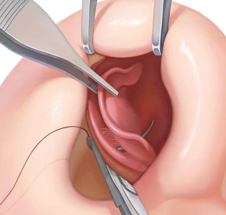 三、張承武初鼻3.8w起貴在哪？和普通初鼻拉開的差距是什么www.sorencai.cn