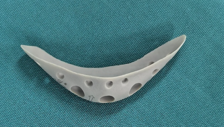 五、PEEK材料的常見疑問解答