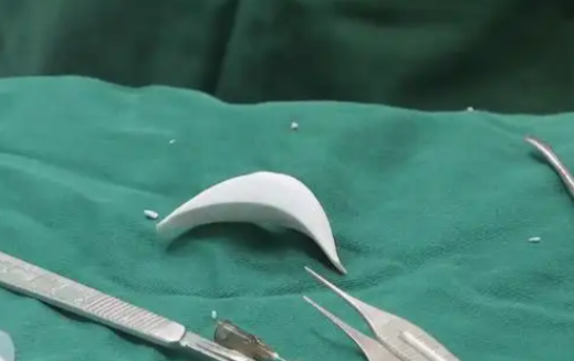 四、PEEK下巴手術(shù)的預(yù)約及到院攻略