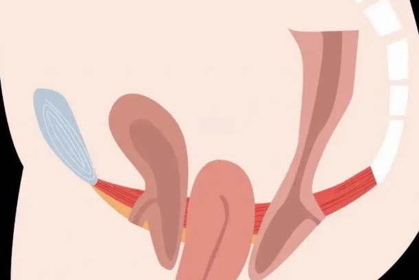 陰道緊縮手術(shù)術(shù)后變好階段