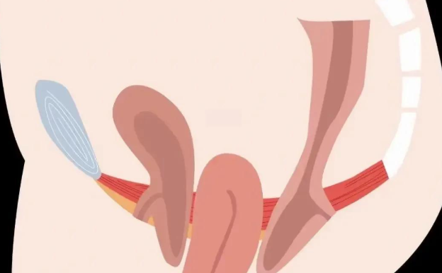 緊縮手術(shù)25天了能吃辣了嗎？