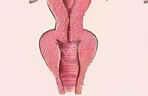 為何緊縮手術(shù)25天不建議吃辣