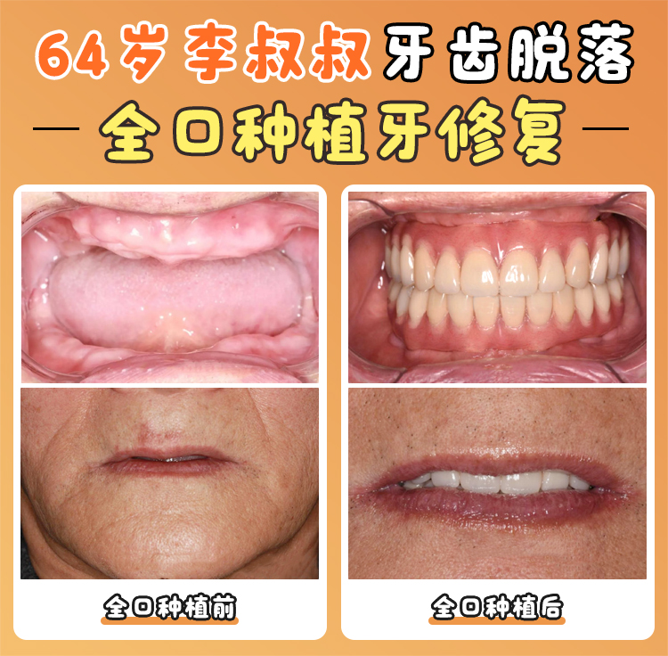 李延峰醫(yī)生：高難度種植技術(shù)骨干醫(yī)生www.sorencai.cn