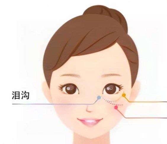 二、徐墩醫(yī)生雙眼皮手術(shù)價格明細(xì)：6800元起包含哪些項目？