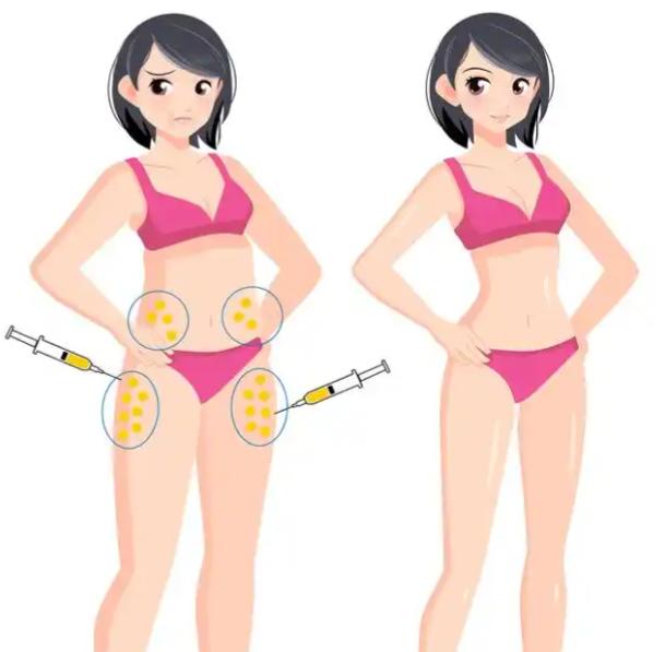 二、包濤醫(yī)生的吸脂技術(shù)特色解析