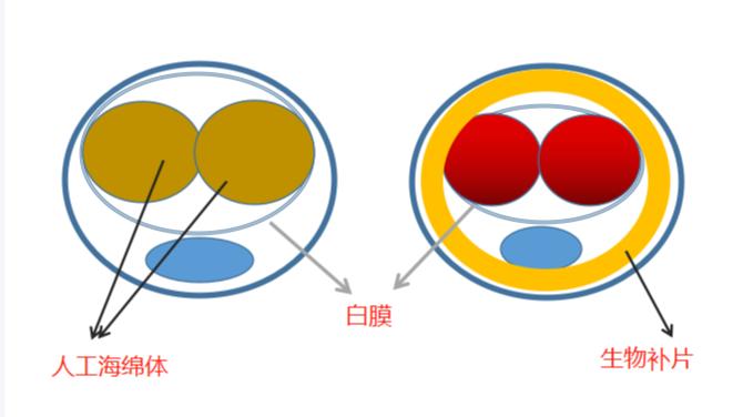 七、李世榮延長增粗價格貴嗎？值不值得？