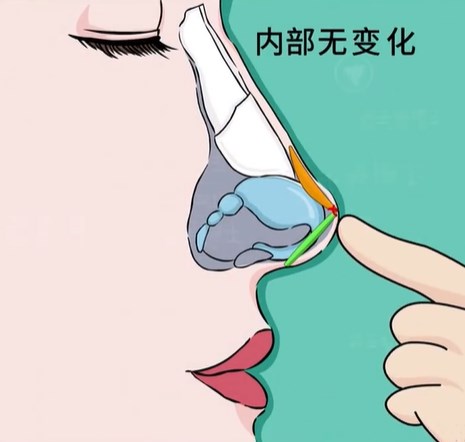 東京貝爾美容外科價(jià)格貴嗎？看完這份全價(jià)目解析你就明白了