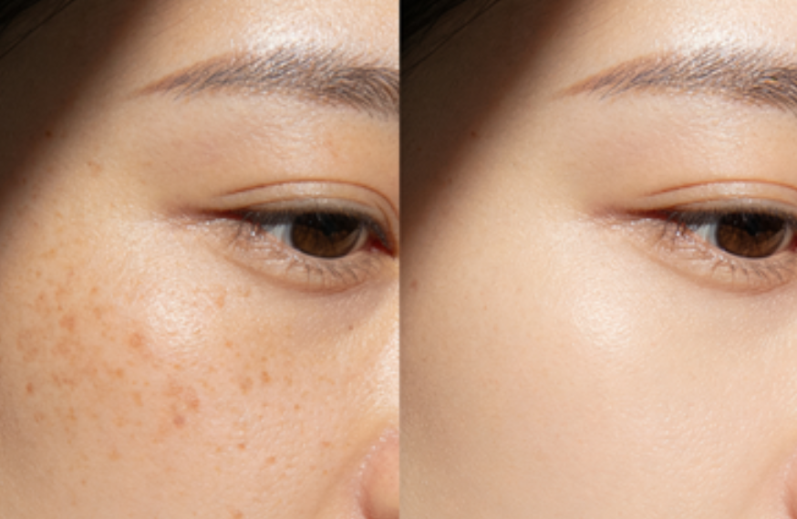 赴韓美容預(yù)約避坑指南：大領(lǐng)館提醒的關(guān)鍵細節(jié)