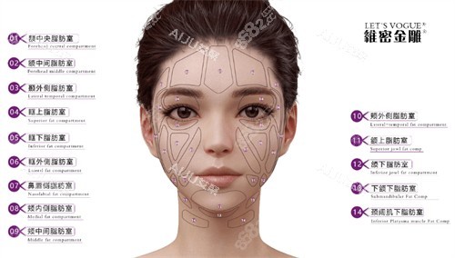 維密金雕可治療部位