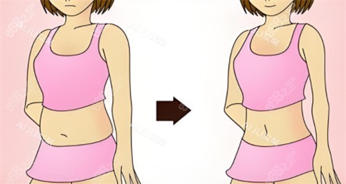 吸脂對(duì)比圖 吸脂對(duì)比圖