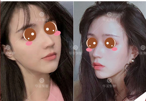 貴陽(yáng)華美紫馨美面部提升項(xiàng)目?jī)r(jià)格