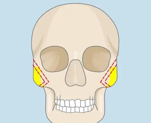 廣州杜本軍和柳超手術(shù)風(fēng)格對比