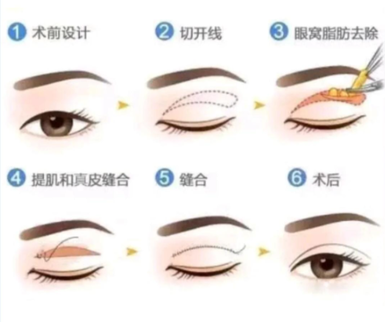 嬌點整形馬占軍手術(shù)技術(shù)優(yōu)勢