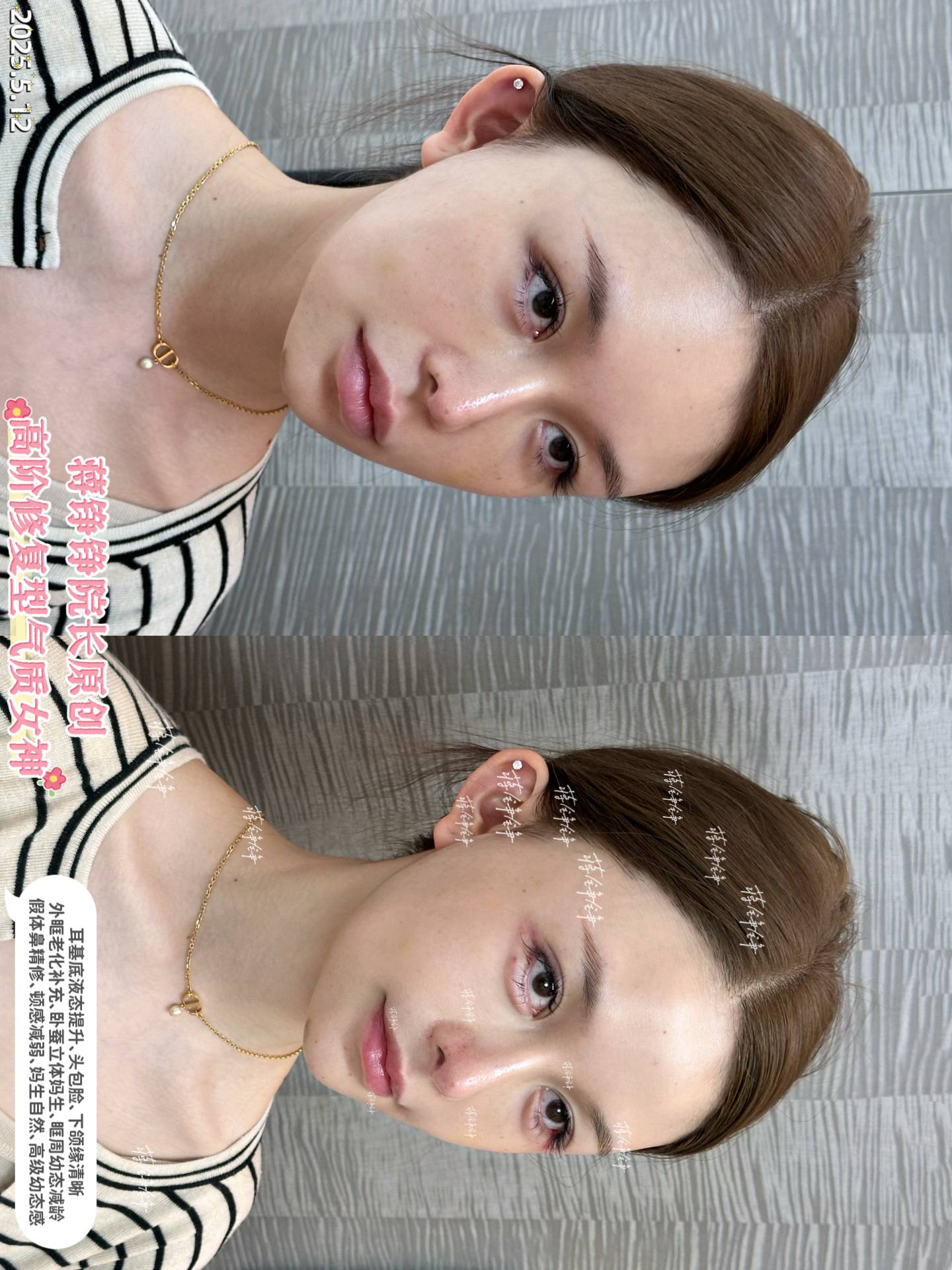 武漢口碑好的整形注射醫(yī)生楊杰：技術實力超厲害