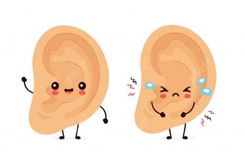 于曉波杯狀耳修復實例術后變好要點，提升滿意度的關鍵