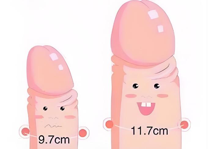 四、張國喜假體三件套手術(shù)有哪些注意事項