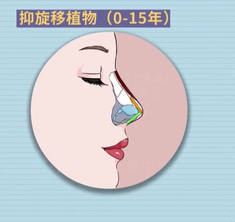 成都美麗之星整形醫(yī)院項(xiàng)目與價(jià)格