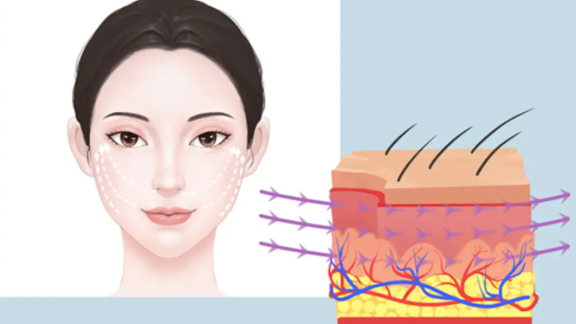 范巨峰做線雕多少錢