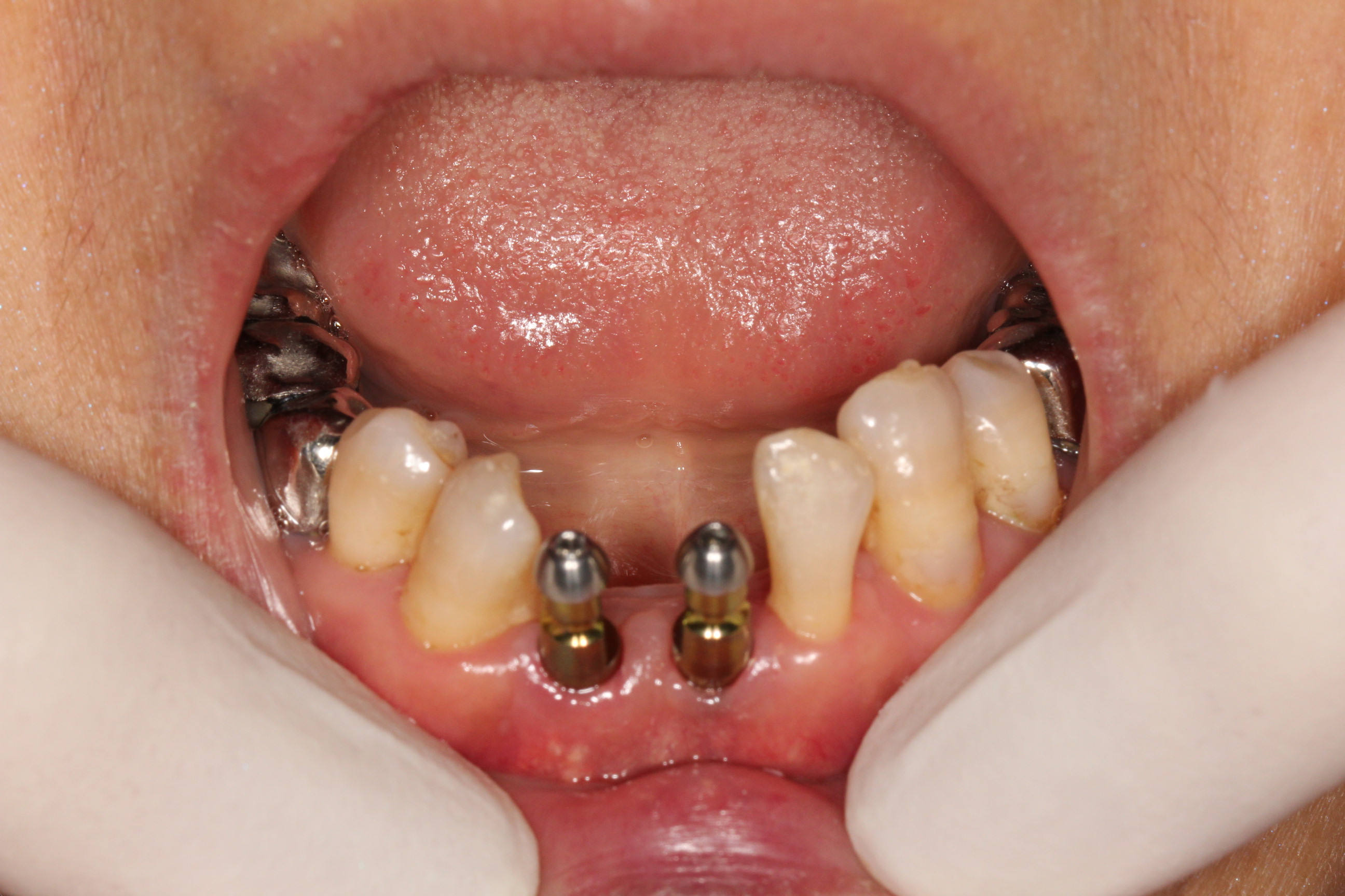 四、深圳正恩口腔：連鎖優(yōu)勢，實(shí)力鑄就地位