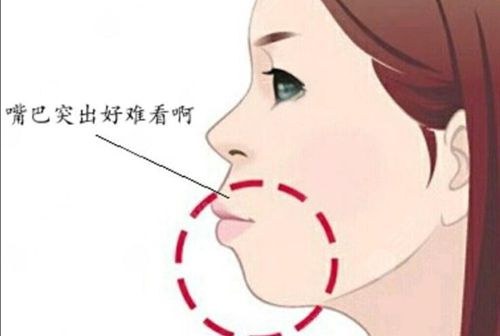 正頜手術納入醫(yī)療保險了嗎