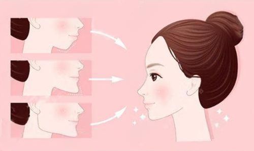 重慶松山醫(yī)院正頜手術口碑好