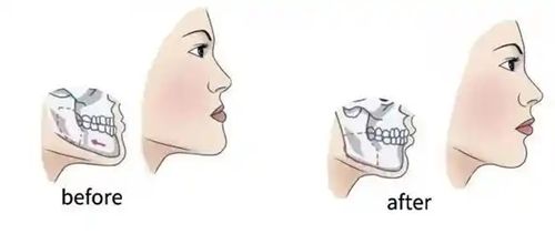 廣州王濤正頜在哪個(gè)醫(yī)院？答案來了！坐診廣州韓妃整形外科（越秀院區(qū)），四級頜面資質(zhì)齊全！
