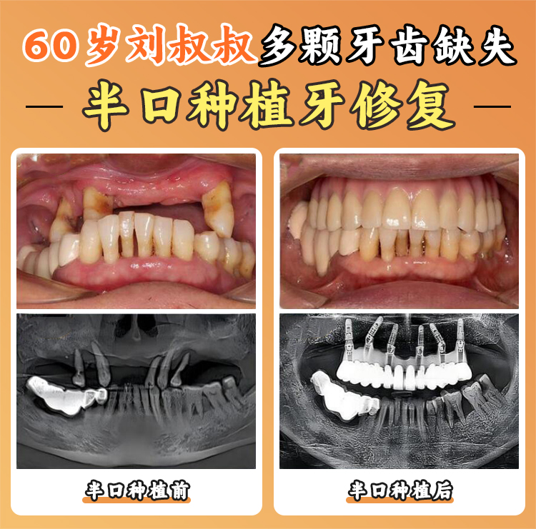上海鼎植口腔——高难度种植的专精机构www.8682.cc