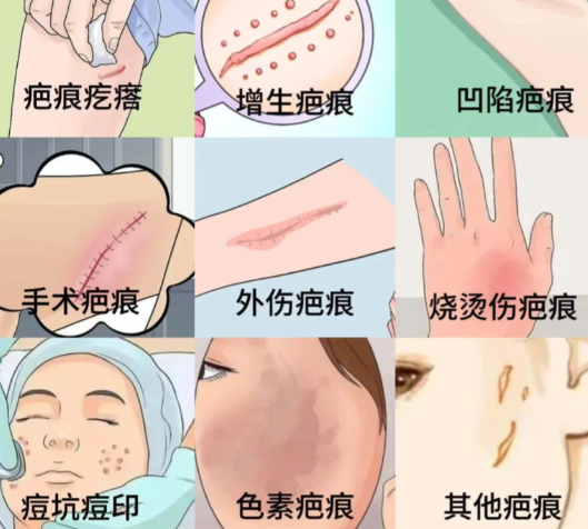 4. 長(zhǎng)沙盈康醫(yī)院瘢痕科