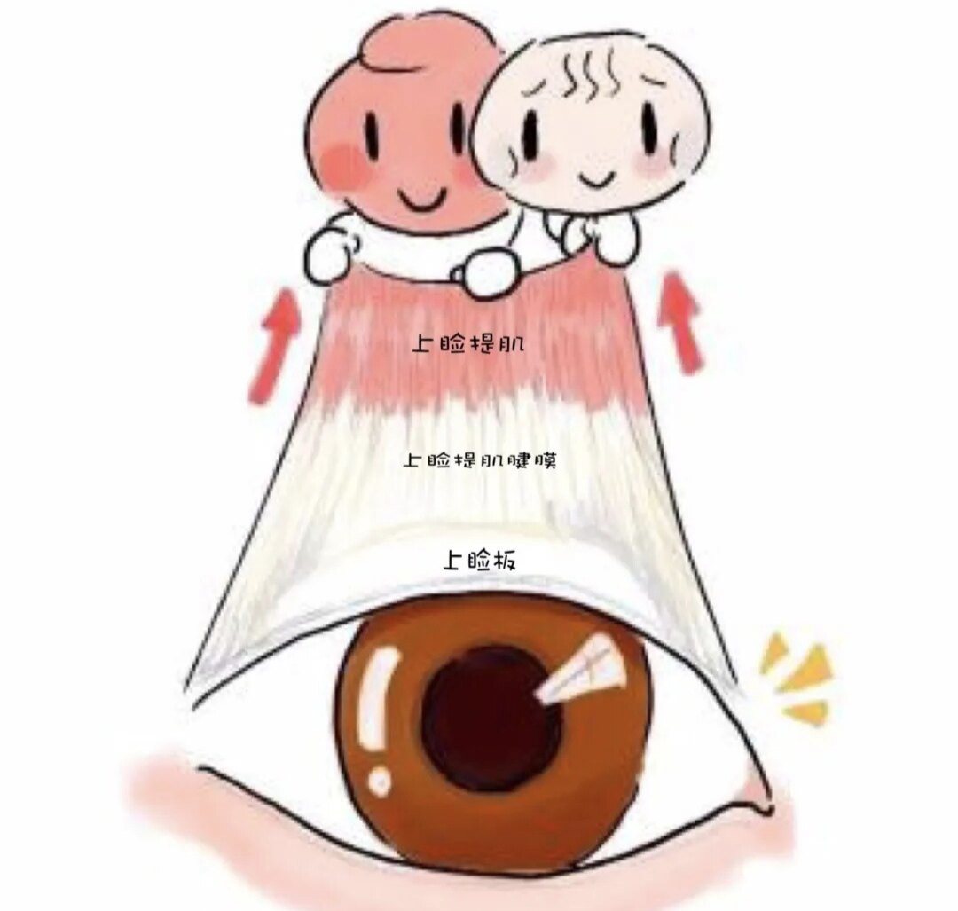 黃丹平醫(yī)生上瞼下垂修復(fù)的費(fèi)用情況:2.5-3.5W到底值不值