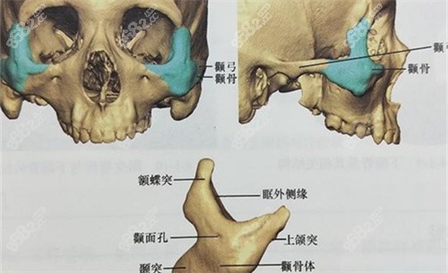 顴骨顴弓位置展示圖