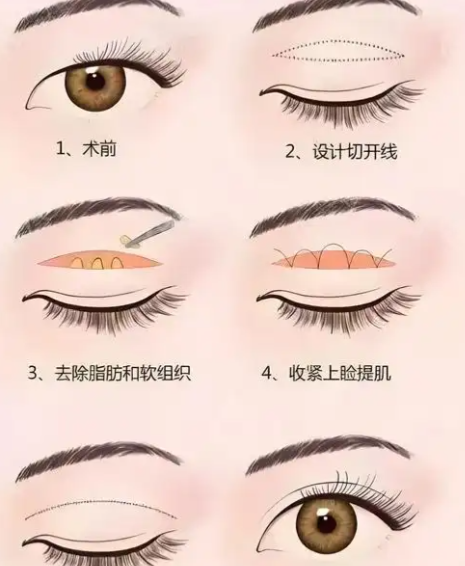 技術(shù)特點(diǎn)大揭秘：余波鴻“穩(wěn)準(zhǔn)解剖”VS曹林“顯微精修”