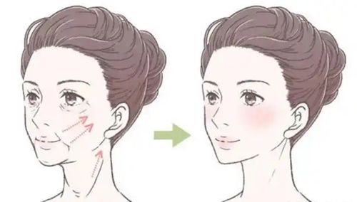 鄭州溫志華醫(yī)生面部提升價(jià)格