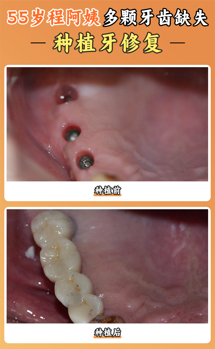 公開北京中諾口腔醫(yī)院大眾點(diǎn)評(píng)：正畸體驗(yàn)良好