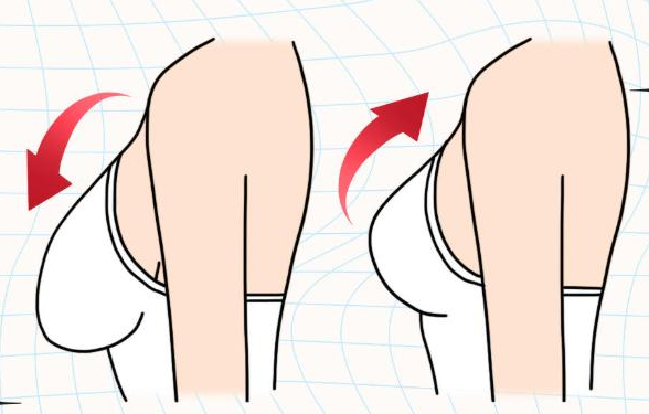 連云港哪里有能做縮胸手術(shù)的？