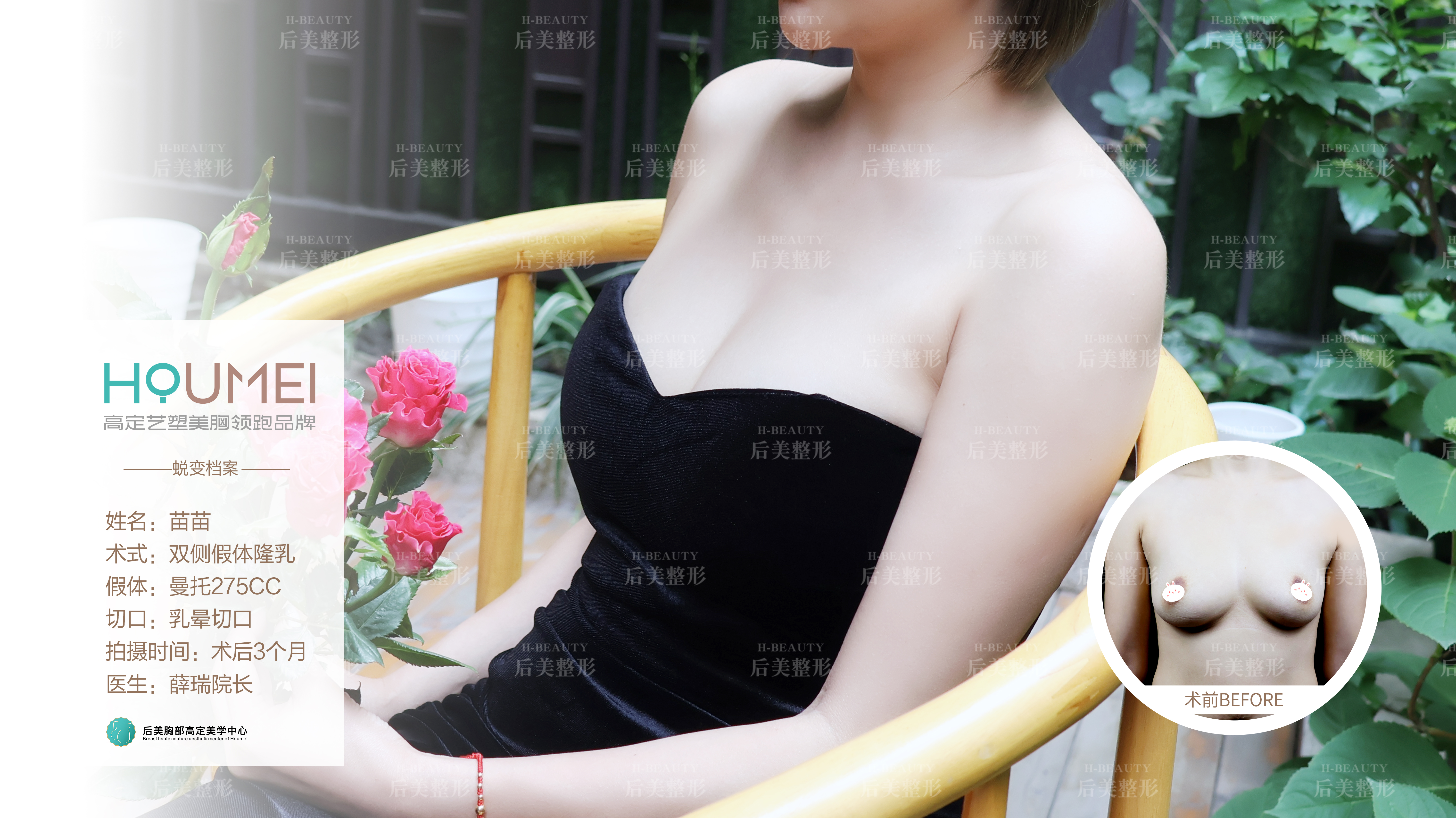 術(shù)后修復(fù)