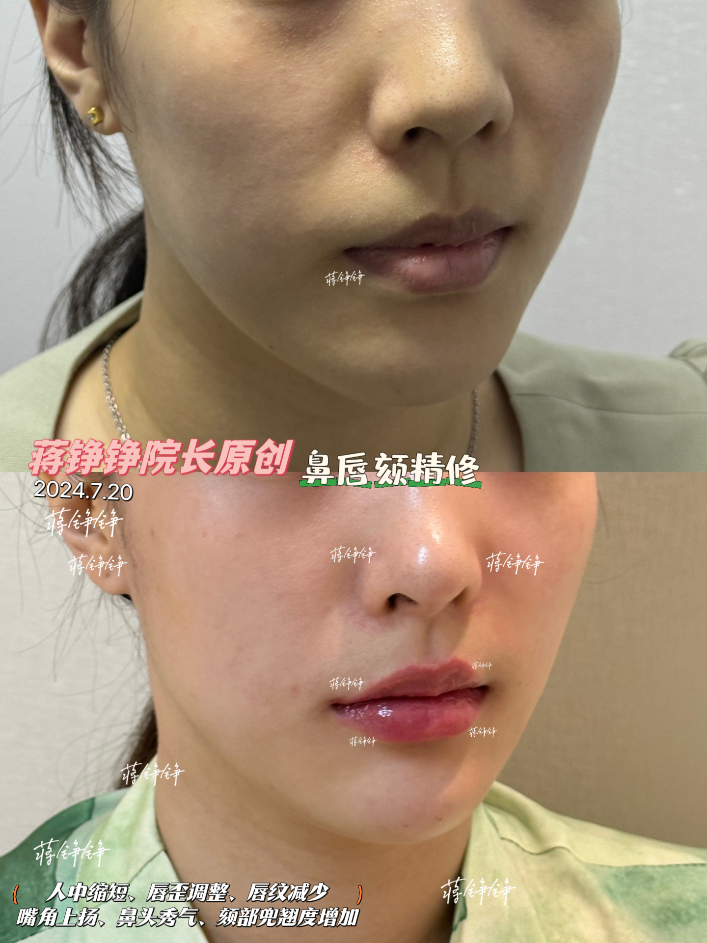 栗勇醫(yī)生的技術(shù)優(yōu)勢簡直絕了