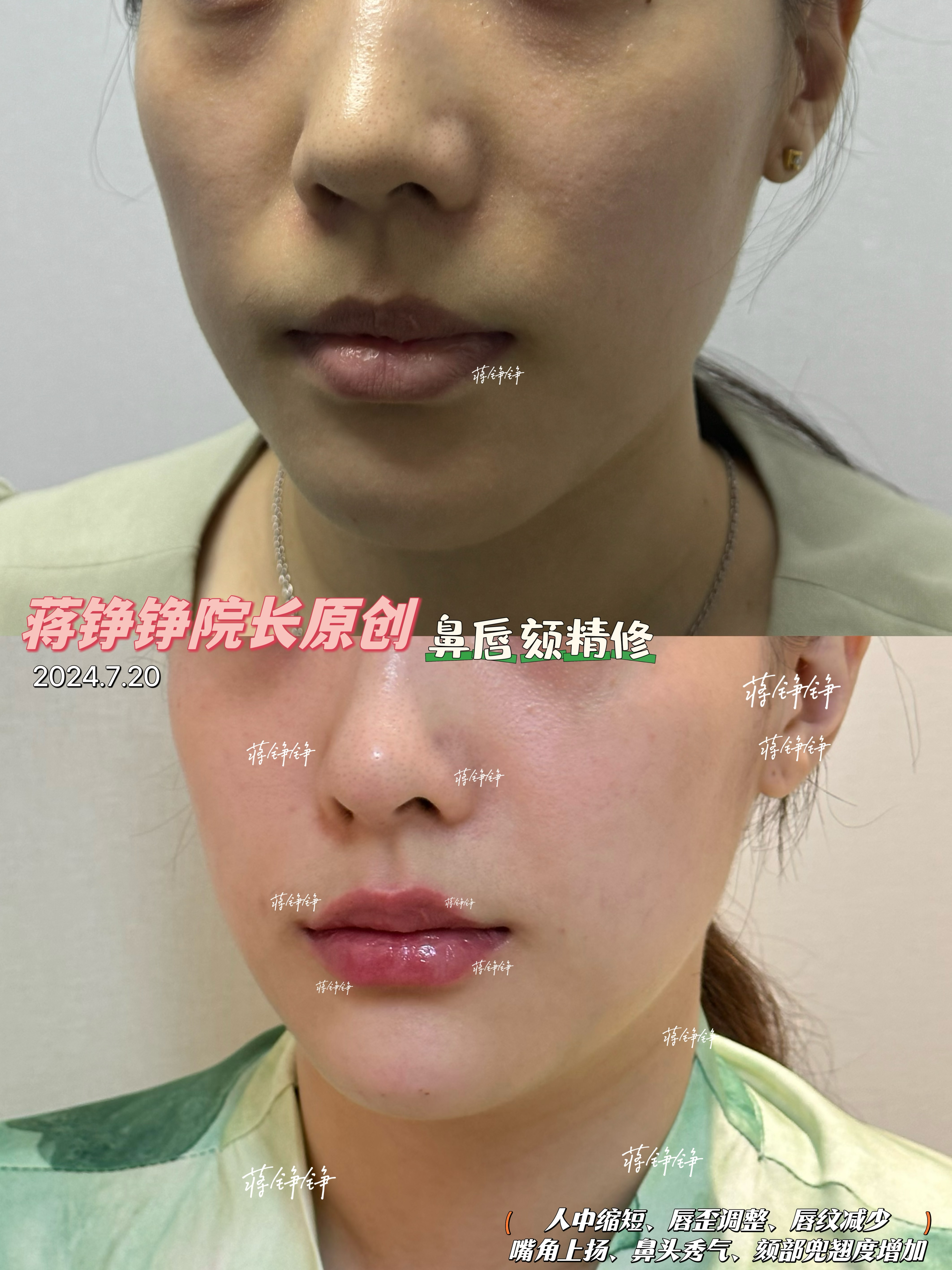 術(shù)后修復的那些事兒