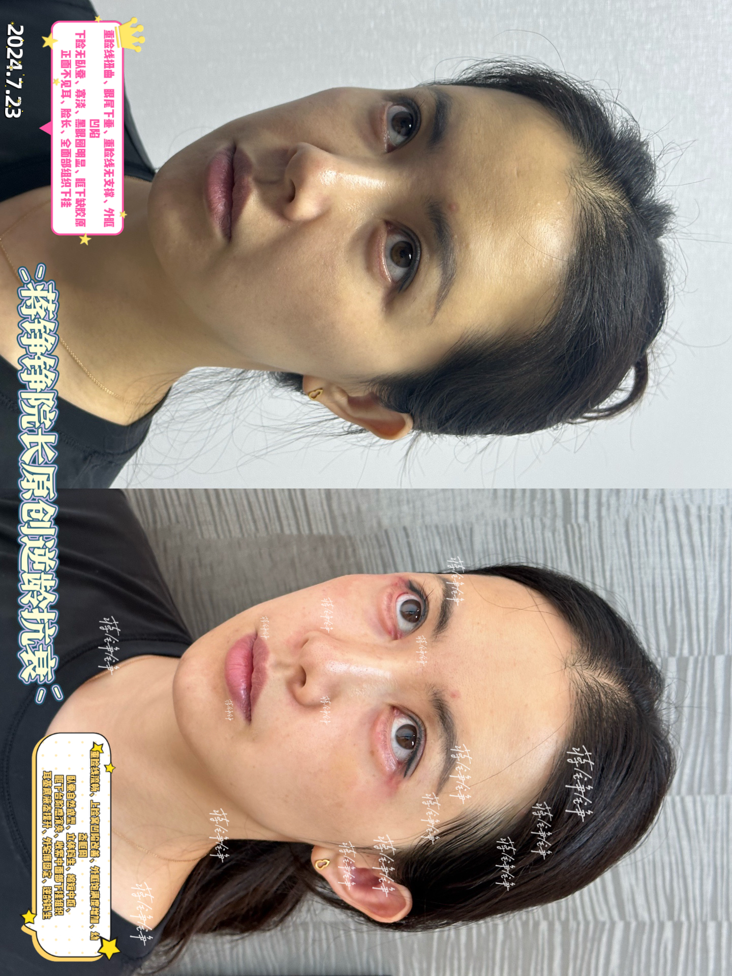 杭州美萊栗勇醫(yī)生預約掛號技巧