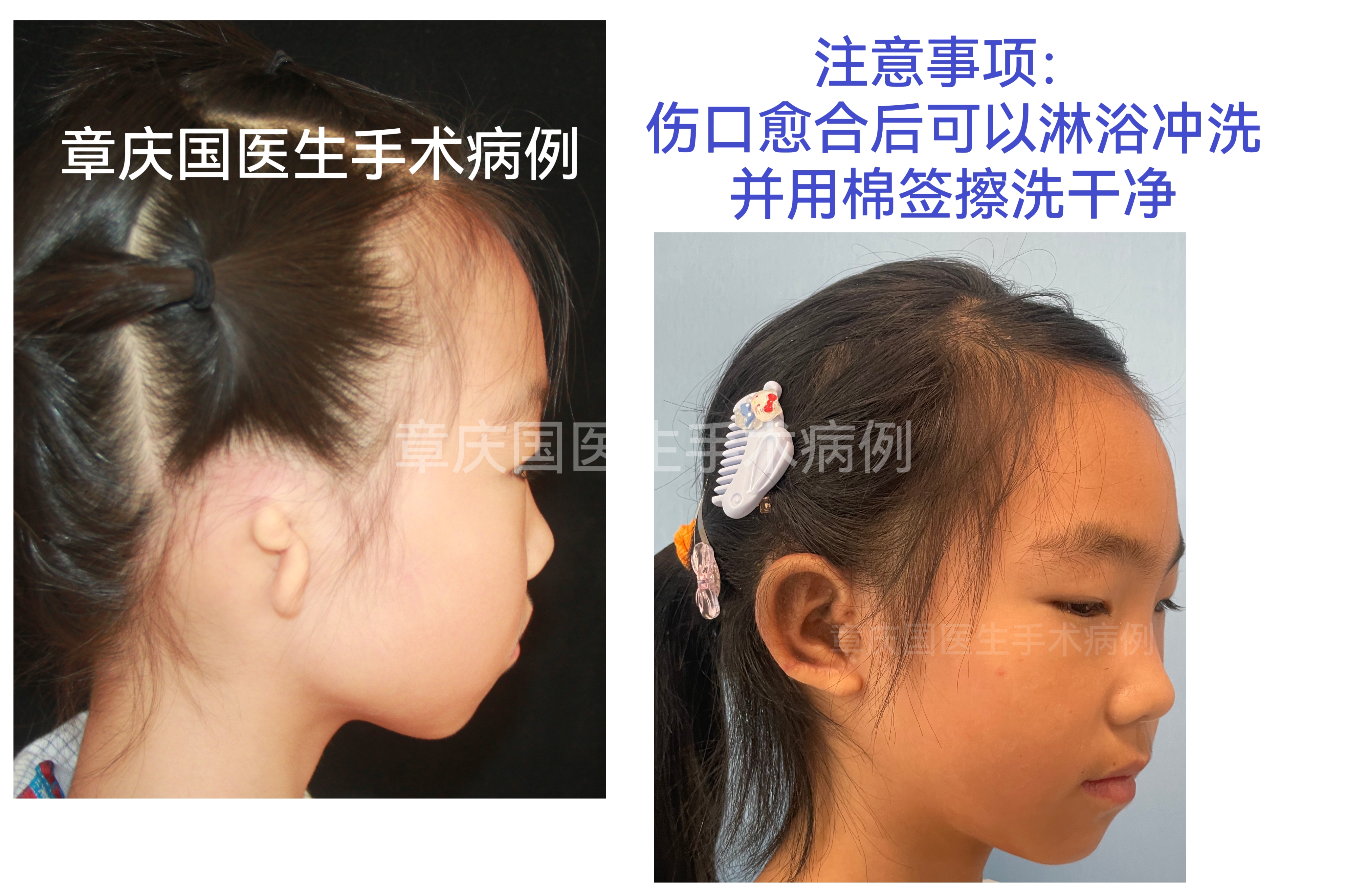 為什么選擇欒杰醫(yī)生：專精、經(jīng)驗(yàn)、口碑缺一不可