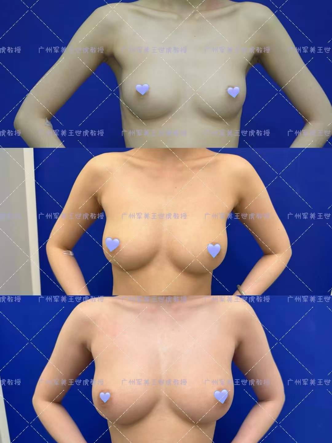 七、謝衛(wèi)國醫(yī)生預(yù)約掛號方式和注意事項(xiàng)