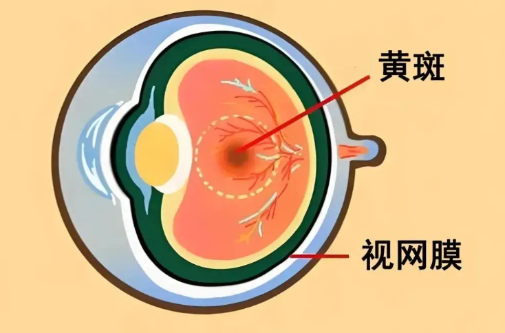 一、視網(wǎng)膜脫落10年了眼睛沒有萎縮是真假？這種情況為何會(huì)發(fā)生？