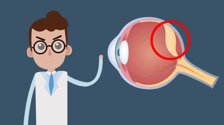 四、視網(wǎng)膜脫落10年了眼睛沒有萎縮是真假？應(yīng)選擇怎樣的醫(yī)院和診療技術(shù)？