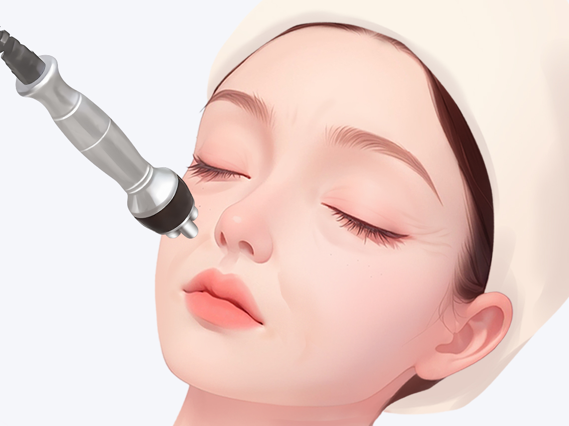 六、微創(chuàng)提升術(shù)的適用人群與注意事項