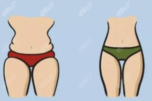 腿部吸脂對比圖