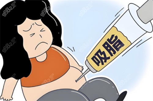 非正規(guī)吸脂術(shù)