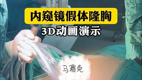 我國(guó)公認(rèn)豐胸口碑最好的醫(yī)生推薦名單