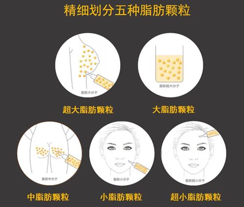 脂肪醫(yī)生梁耀嬋怎么樣