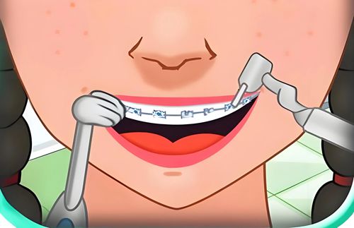 南京隱形牙套天包地矯正價格表明細(xì)匯總